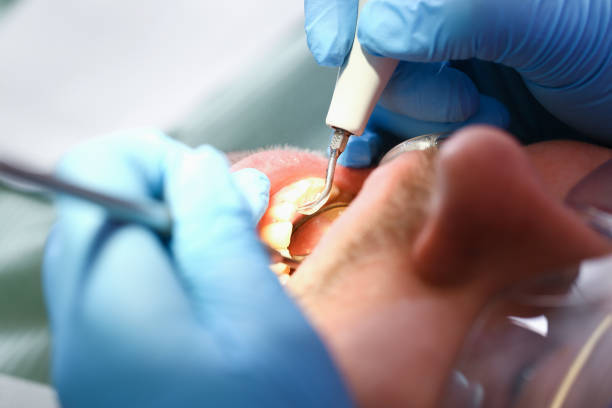 Trusted CA Emergency Dental Service Experts